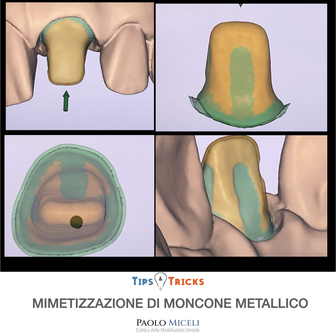 Day Lab #4 — diapositiva 4 — tecnica dell'intercapedine