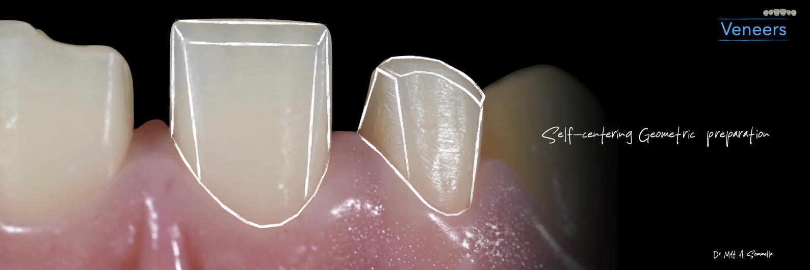 Lavorazione odontotecnica dell'Odt. Paolo Miceli — immagine 4