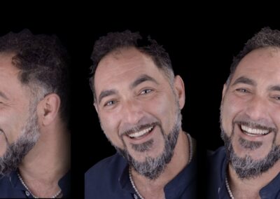 Rapporto con il viso del paziente del restauro terminato. Si noti già nelle immagini la ritrovata serenità non solo dovuta alla estetica rinnovata ma anche ad una nuova occlusione confortevole e funzionale.