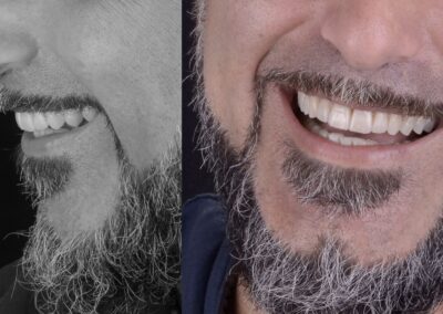 Funzione ed estetica raggiunte in un perfetto equilibrio tra le parti.